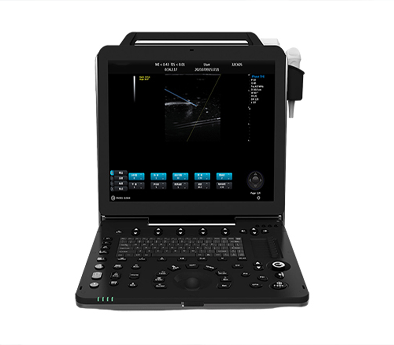 Portable Ultrasound Systems Gain Traction as First-Line Tool for Point-of-Care Diagnostics