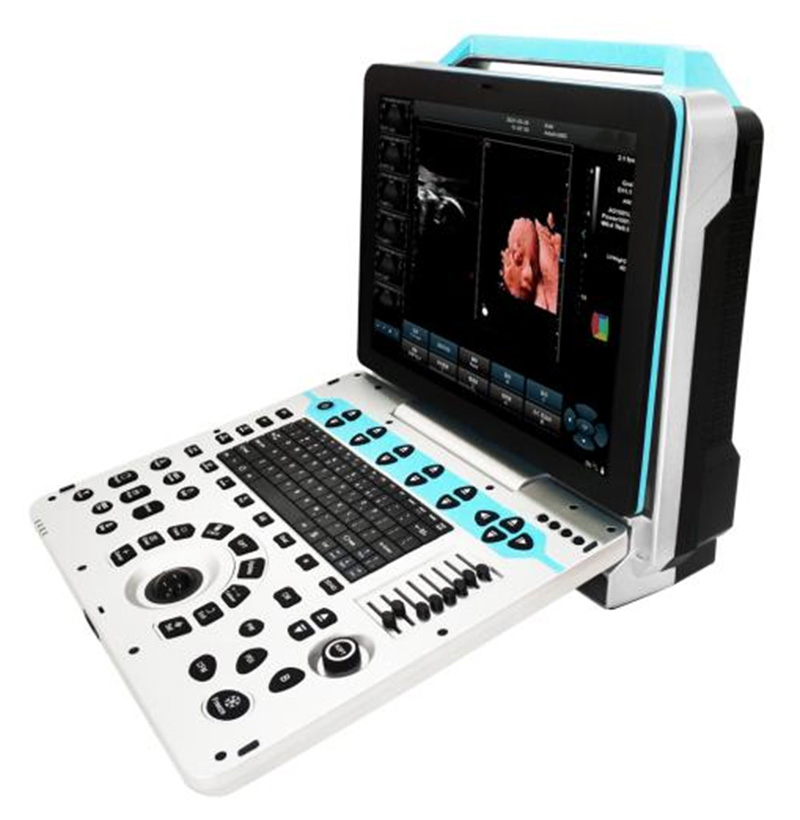 SM-40P 3D_4D_5D escáner portátil de ultrasonido de color digital completo
