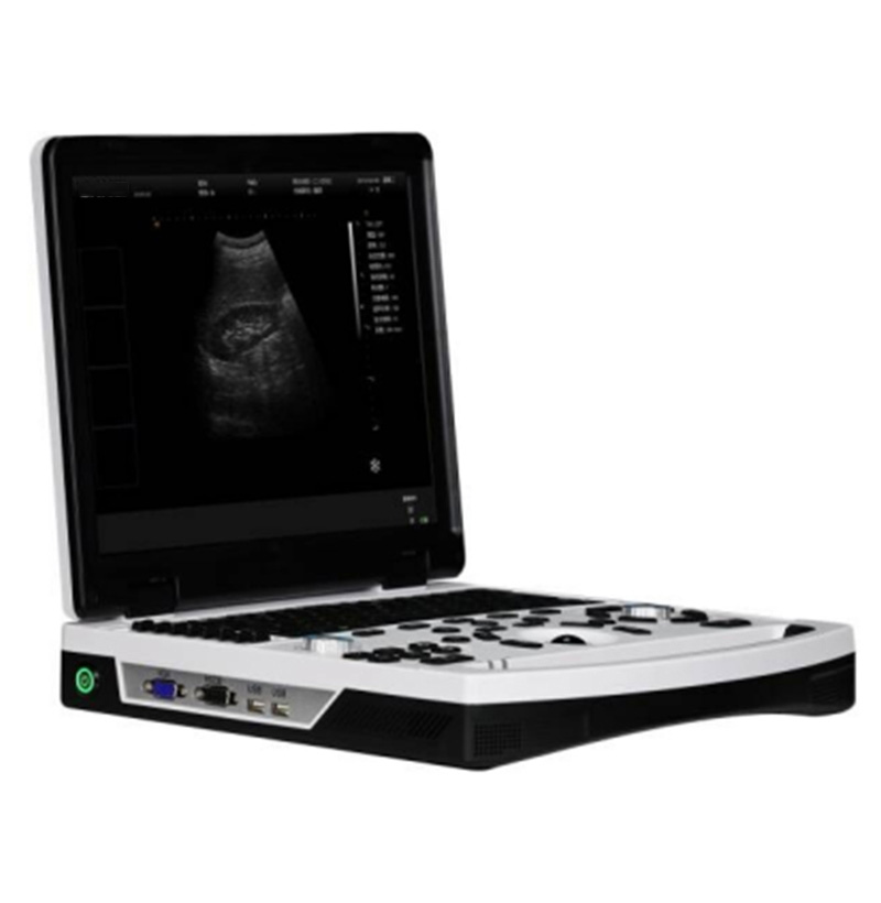 Sistema dignóstico de ultrasonido negro y blanco para ordenador portátil SM-60E