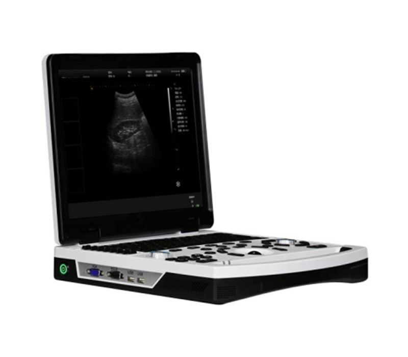 SM-60E Laptop Black and White Ultrasound Dignostic System