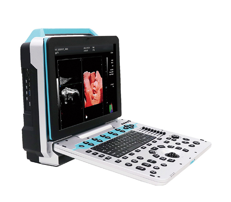 SM-60P 3D_4D_5D Portable Full Digital Color Ultrasound Scanner