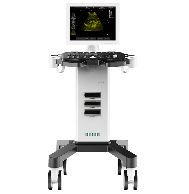 SM-70T completo carro digital negro y blanco sistema dignóstico de ultrasonido-1