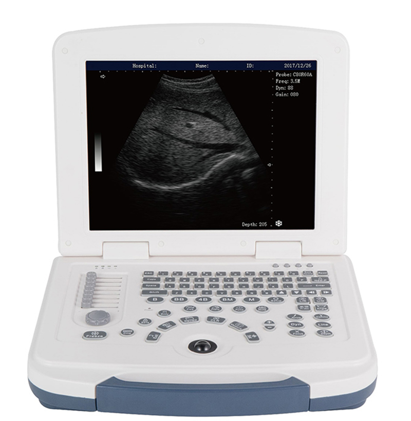 Sistema de diagnóstico ultrasónico del tipo de computadora portátil SM-90D BW