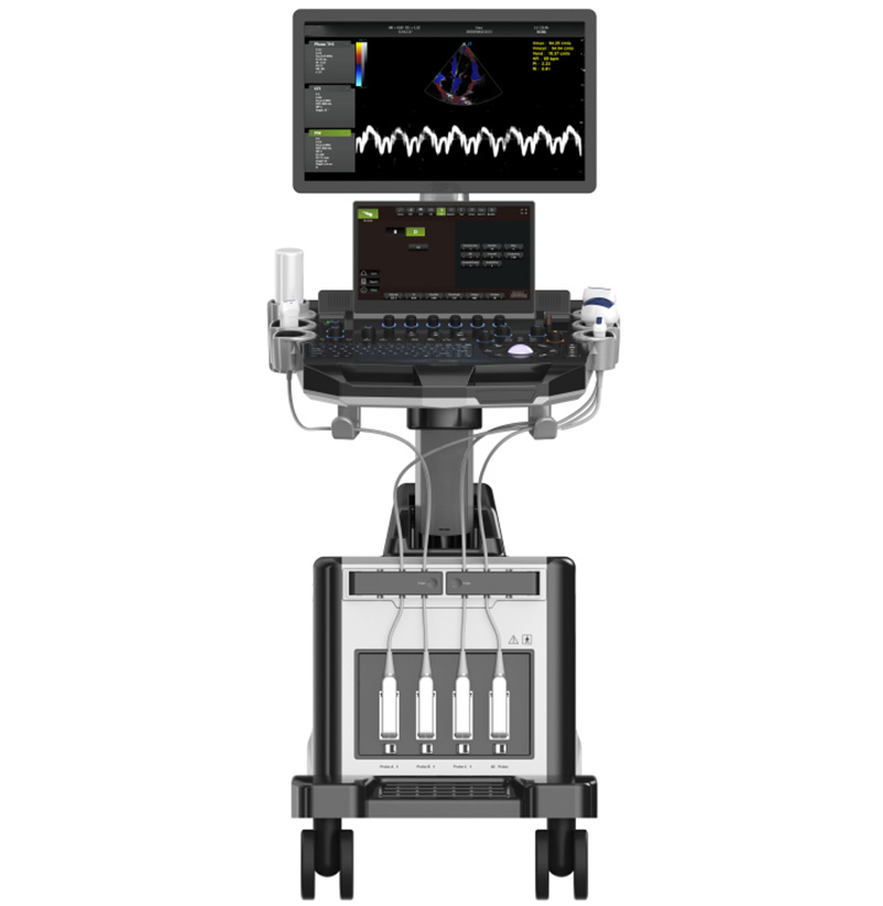 SM-90T 3D_4D_5D Trolley Digital Color Ultrasound Scanner