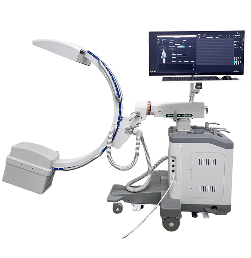 SMC-1500D Flat-panel Detector Mobile C-arm X-ray Machine