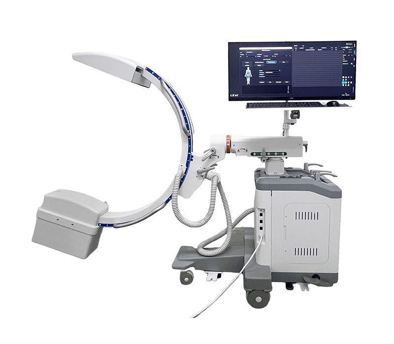 SMC-1500D Flat-panel Detector Mobile C-arm X-ray Machine