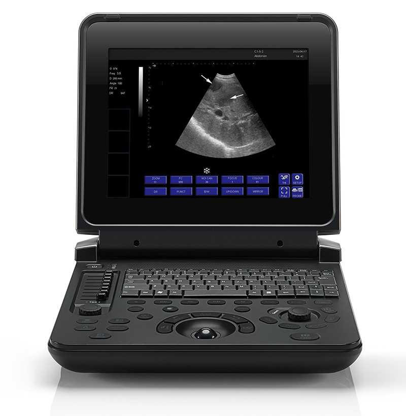 Sistema de ultrasonido de diagnóstico completo digital SM-12A