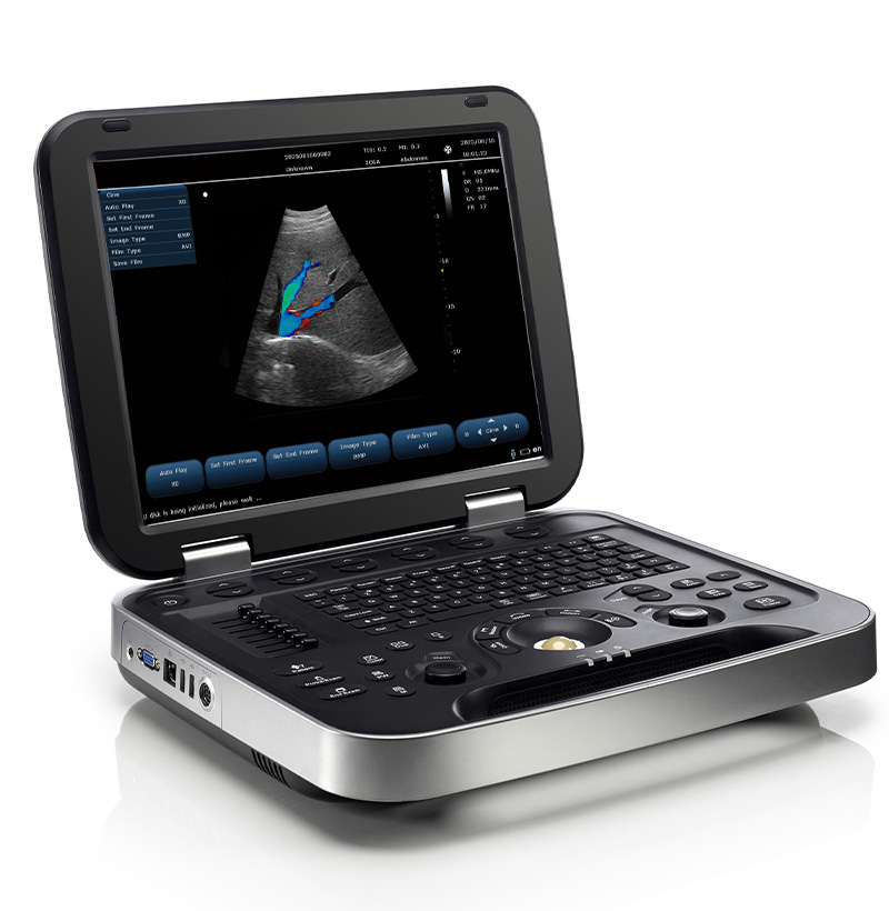 Sistema de diagnóstico de ultrasonido de color Doppler SM-15A(1)