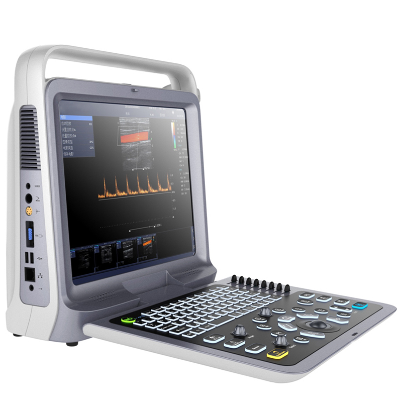 Escáner de ultrasonido