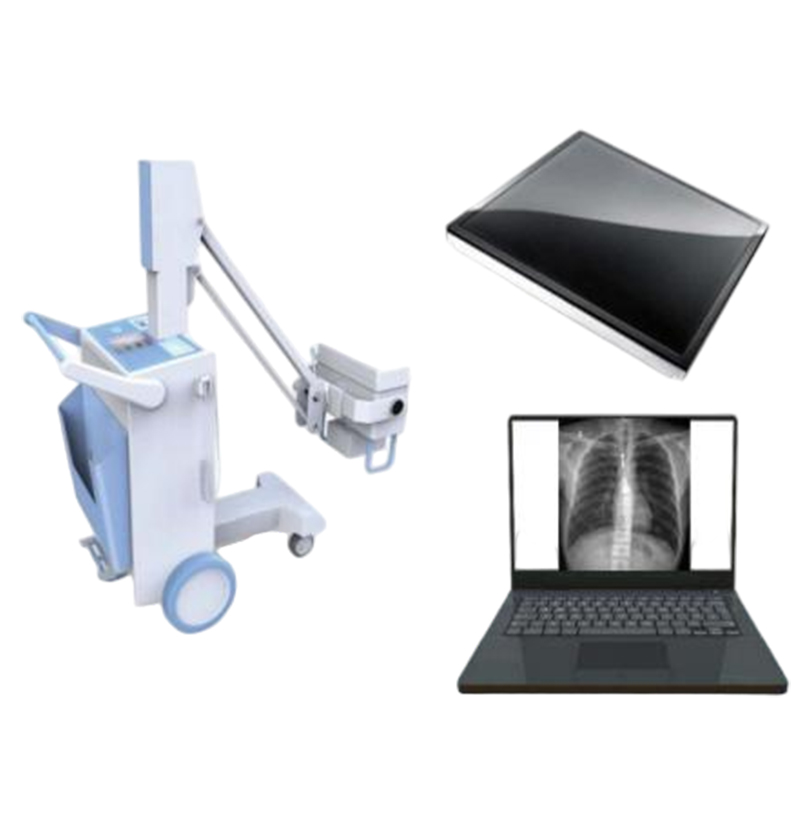 SMT-50MD Digital Mobile X-ray System