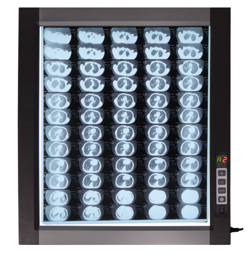 Visor de rayos X led ST-1D