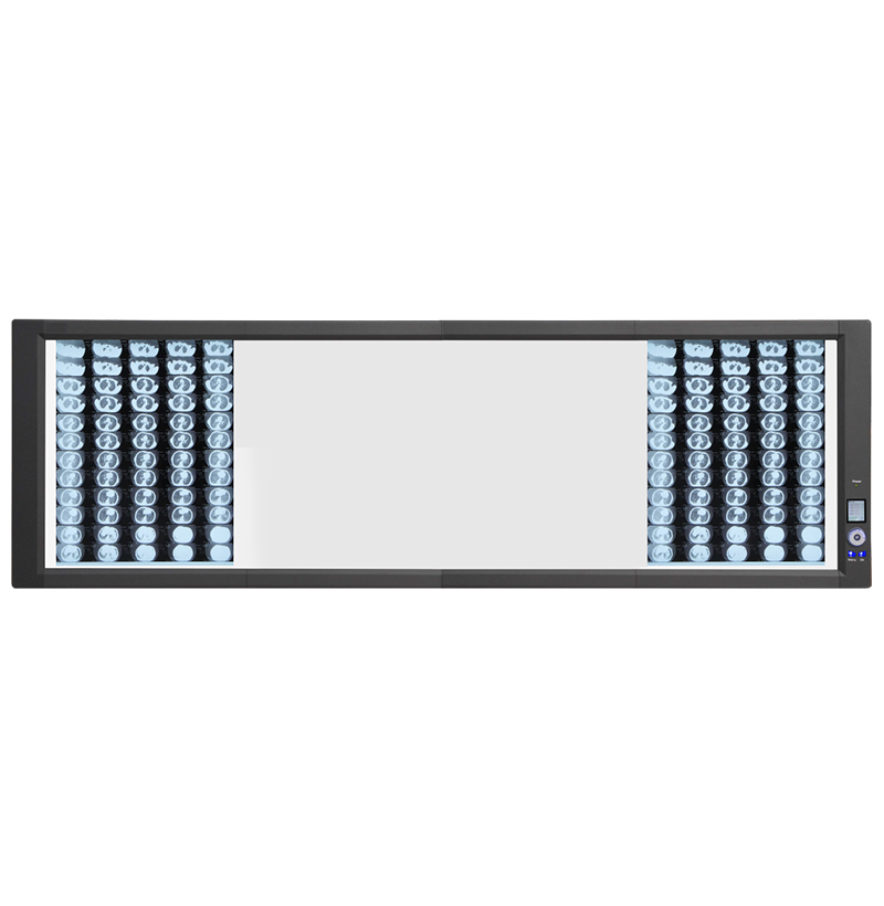 ST-4 Visor de rayos X LED retroiluminado