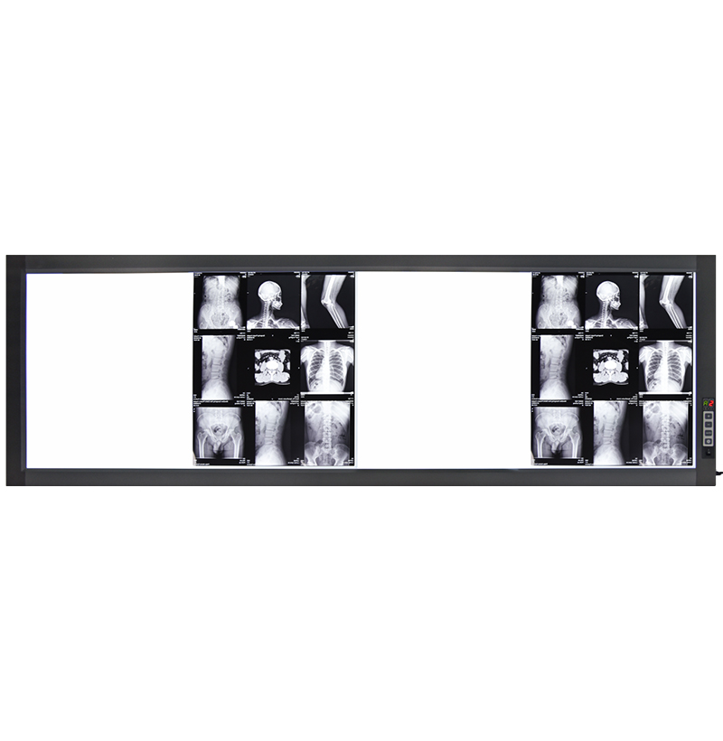 Visor de rayos X led ST-4D