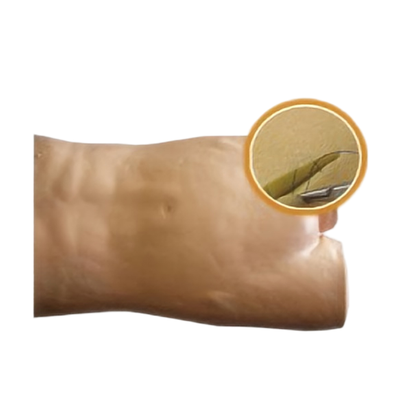 Modelo de entrenamiento de sutura de incisión abdominal médica SY20